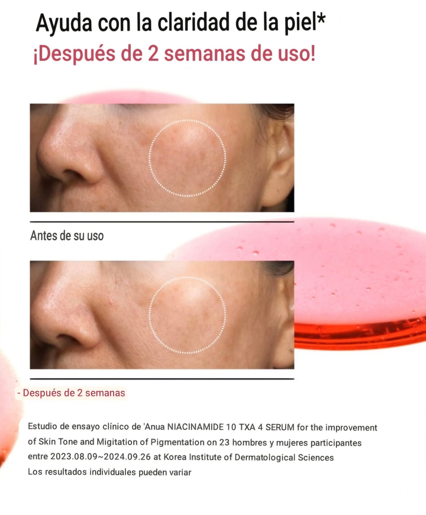 Anua Niacinamide 10% + TXA 4% serum 30ml
