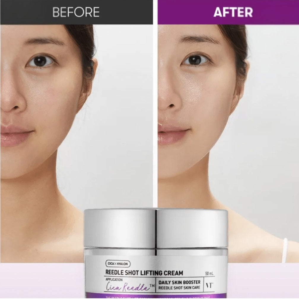 VT Cosmetics
Reedle Shot Lifting Cream
50ml