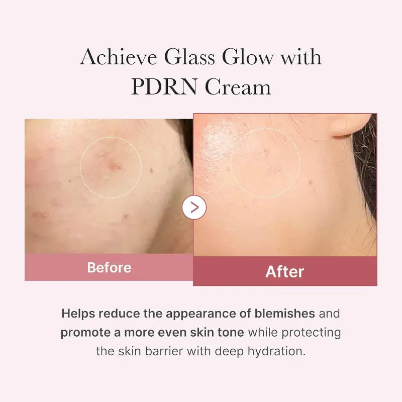 Medicube PDRN Pink Hyaluronic Moisturizer