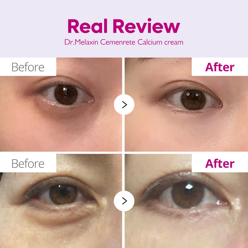 Dr. Melaxin Cemenrete Calcium Intense Cream (50 ml)