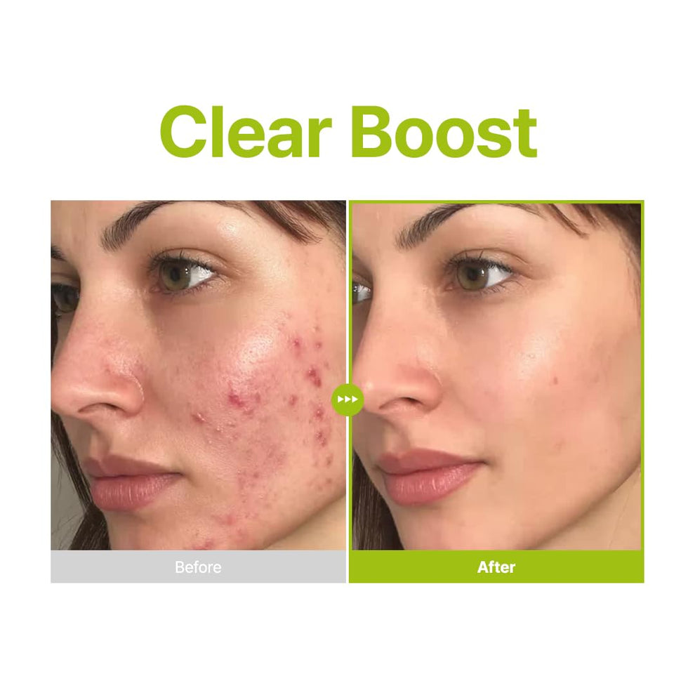 Purito Seoul Azelaic Acid 10 Kojic Tea Tree Serum