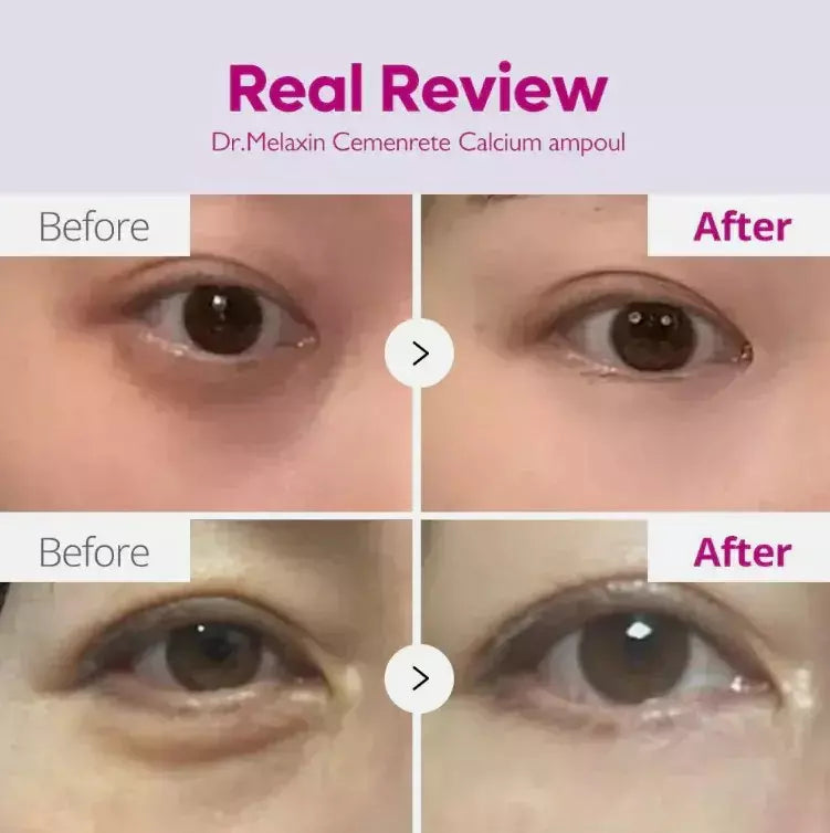 Dr.Melaxin Eyephalt Eyebag Cream [10ml]