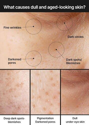 CELIMAX Pore+Dark Spot Brightening Cream